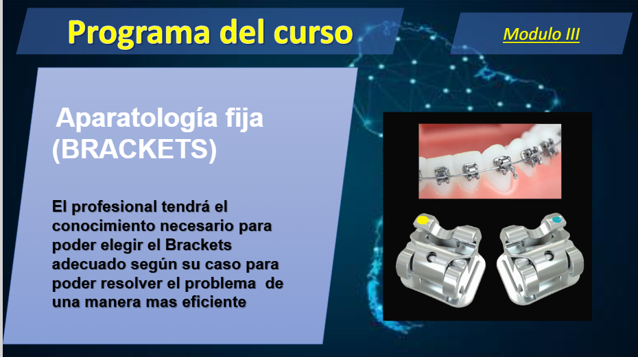 Modulo 3